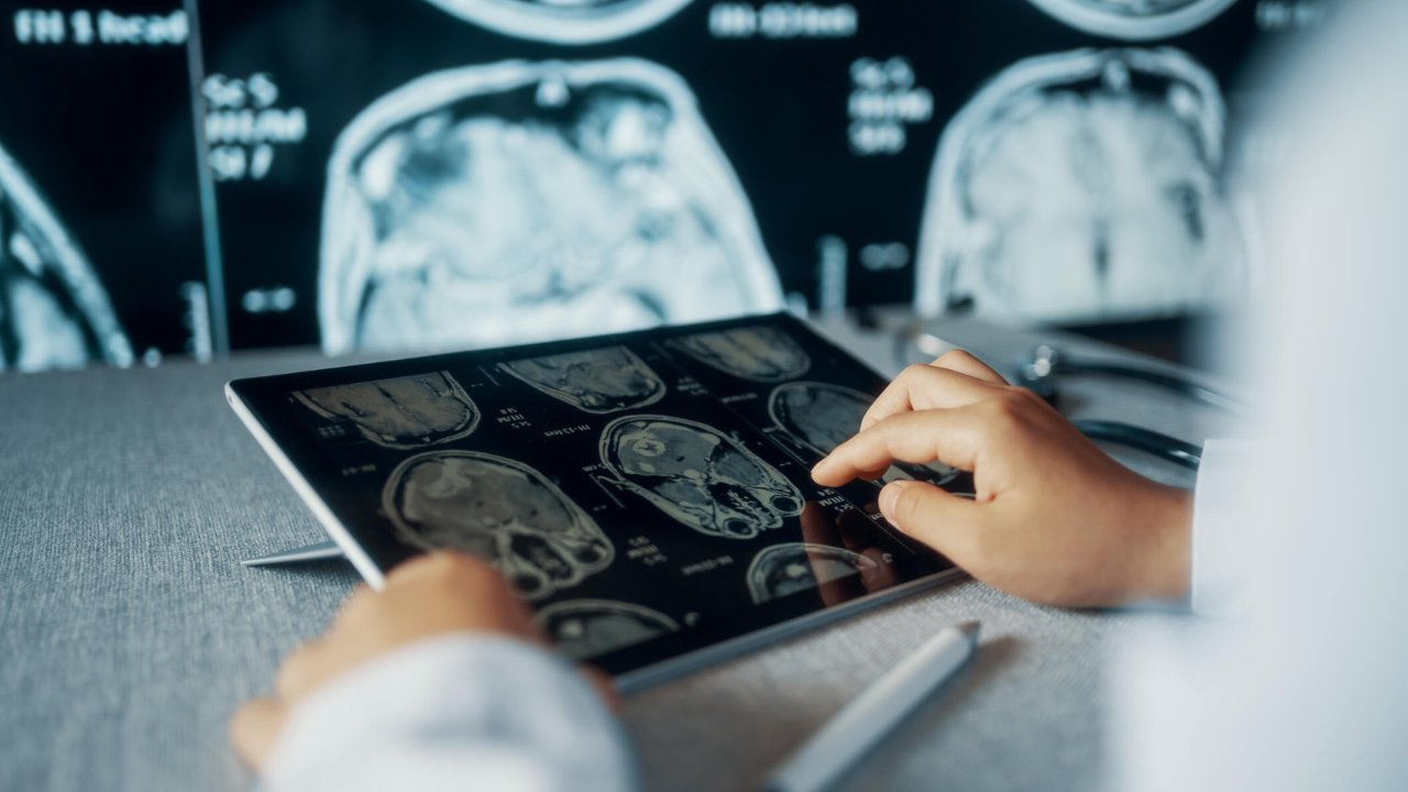 The Hidden Costs of PACS What You Need to Know Before Investing in Medical Imaging Solutions - Presented by PostDICOM